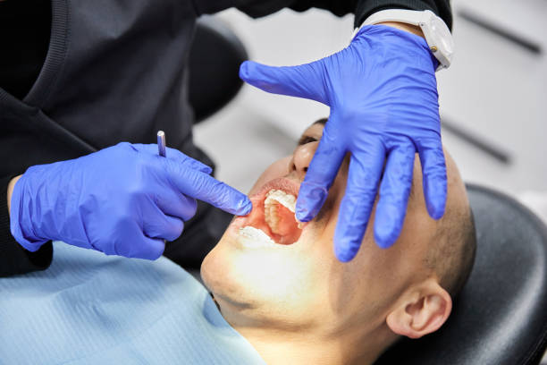 Best Emergency Treatment for Dental Infections or Abscesses in Selma, CA
